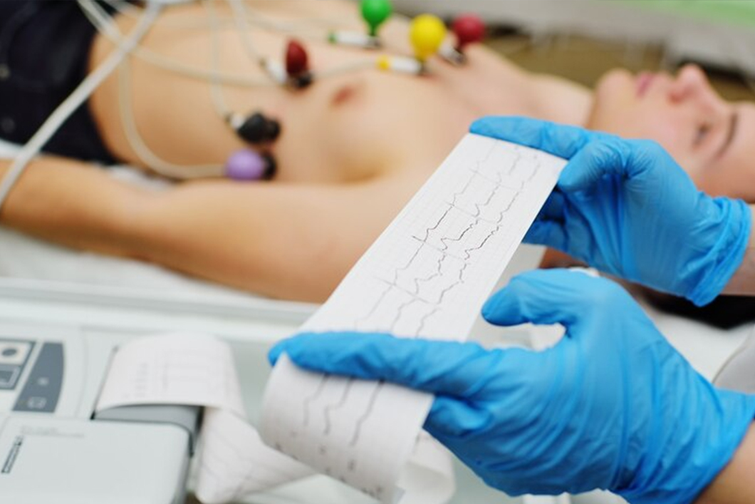 ECG